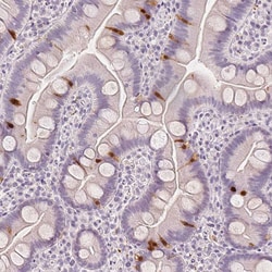 Invitrogen SCGN Monoclonal Antibody (CL0273) 100 &mu;L; Unconjugated:Antibodies,