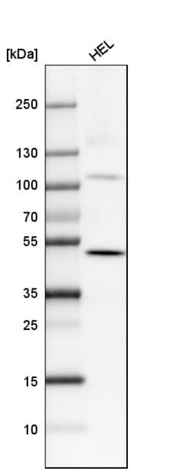 Invitrogen SATB2 Monoclonal Antibody (CL0276) 100 &mu;L; Unconjugated:Antibodies,