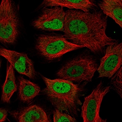 Invitrogen RBM3 Monoclonal Antibody (CL0296) 100 &mu;L; Unconjugated:Antibodies,