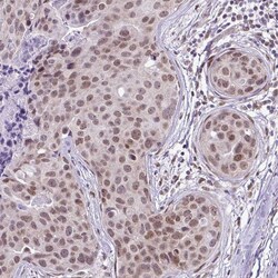 Invitrogen RBM3 Monoclonal Antibody (CL0296) 100 &mu;L; Unconjugated:Antibodies,