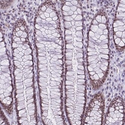 Invitrogen RBM3 Monoclonal Antibody (CL0296) 100 &mu;L; Unconjugated:Antibodies,