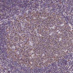 Invitrogen RBM3 Monoclonal Antibody (CL0296) 100 &mu;L; Unconjugated:Antibodies,