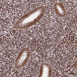 Invitrogen CTCF Monoclonal Antibody (CL0305) 100 &mu;L; Unconjugated:Antibodies,