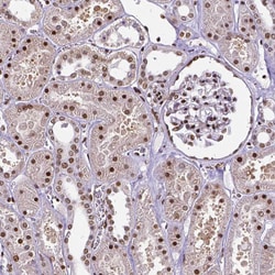 Invitrogen CTCF Monoclonal Antibody (CL0305) 100 &mu;L; Unconjugated:Antibodies,