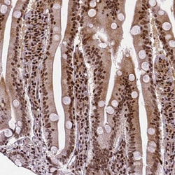 Invitrogen CTCF Monoclonal Antibody (CL0305) 100 &mu;L; Unconjugated:Antibodies,