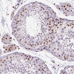 Invitrogen CTCF Monoclonal Antibody (CL0305) 100 &mu;L; Unconjugated:Antibodies,