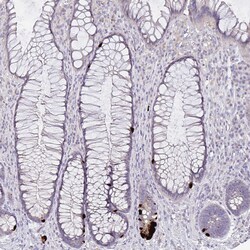 Invitrogen GDF15 Monoclonal Antibody (CL0328) 100 &mu;L; Unconjugated:Antibodies,