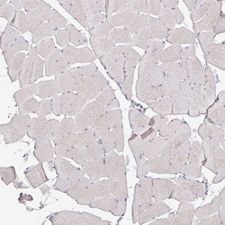Invitrogen GDF15 Monoclonal Antibody (CL0328) 100 &mu;L; Unconjugated:Antibodies,