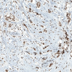 Invitrogen PBRM1 Monoclonal Antibody (CL0331) 100 &mu;L; Unconjugated:Antibodies,
