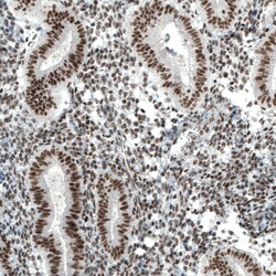 Invitrogen PBRM1 Monoclonal Antibody (CL0331) 100 &mu;L; Unconjugated:Antibodies,