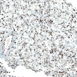 Invitrogen PBRM1 Monoclonal Antibody (CL0331) 100 &mu;L; Unconjugated:Antibodies,