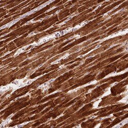 Invitrogen SDHB Monoclonal Antibody (CL0346) 100 &mu;L | Buy Online | Invitrogen&trade; | Fisher Scientific