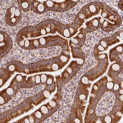 Invitrogen SDHB Monoclonal Antibody (CL0346) 100 &mu;L | Buy Online | Invitrogen&trade; | Fisher Scientific