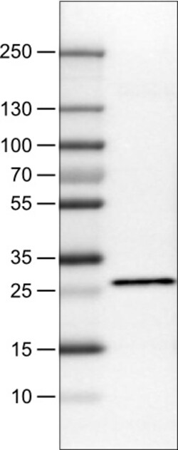 Invitrogen SDHB Monoclonal Antibody (CL0346) 100 &mu;L | Buy Online | Invitrogen&trade; | Fisher Scientific
