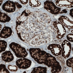 Invitrogen SDHB Monoclonal Antibody (CL0349) 100 &mu;L; Unconjugated:Antibodies,