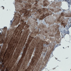 Invitrogen SDHB Monoclonal Antibody (CL0349) 100 &mu;L; Unconjugated:Antibodies,