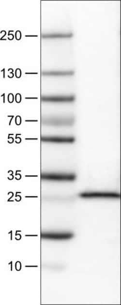 Invitrogen SDHB Monoclonal Antibody (CL0349) 100 &mu;L; Unconjugated:Antibodies,