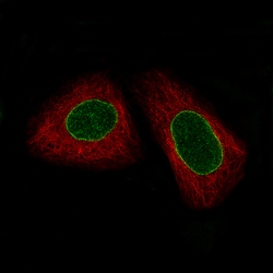 Invitrogen ERCC1 Monoclonal Antibody (CL1249) 100 &mu;L; Unconjugated:Antibodies,