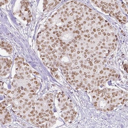 Invitrogen ERCC1 Monoclonal Antibody (CL1249) 100 &mu;L; Unconjugated:Antibodies,