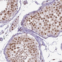 Invitrogen ERCC1 Monoclonal Antibody (CL1249) 100 &mu;L; Unconjugated:Antibodies,