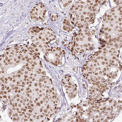 Invitrogen ERCC1 Monoclonal Antibody (CL1284) 100 &mu;L; Unconjugated:Antibodies,