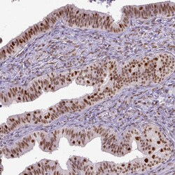 Invitrogen ERCC1 Monoclonal Antibody (CL1284) 100 &mu;L; Unconjugated:Antibodies,