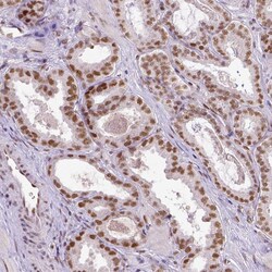 Invitrogen ERCC1 Monoclonal Antibody (CL1284) 100 &mu;L; Unconjugated:Antibodies,