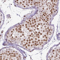 Invitrogen ERCC1 Monoclonal Antibody (CL1284) 100 &mu;L; Unconjugated:Antibodies,