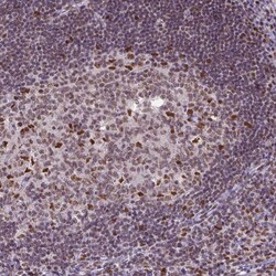 Invitrogen ERCC1 Monoclonal Antibody (CL1284) 100 &mu;L; Unconjugated:Antibodies,