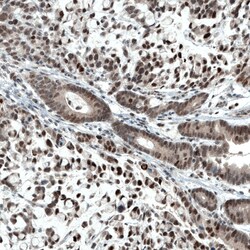 Invitrogen ATF3 Monoclonal Antibody (CL1685) 100 &mu;L; Unconjugated:Antibodies,