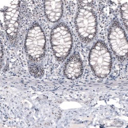 Invitrogen NIFK Monoclonal Antibody (CL2240) 100 &mu;L; Unconjugated:Antibodies,