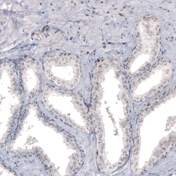 Invitrogen NIFK Monoclonal Antibody (CL2240) 100 &mu;L; Unconjugated:Antibodies,