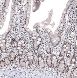Invitrogen NIFK Monoclonal Antibody (CL2237) 100 &mu;L; Unconjugated:Antibodies,