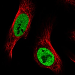 Invitrogen hnRNP C Monoclonal Antibody (CL2593) 100 &mu;L; Unconjugated:Antibodies,