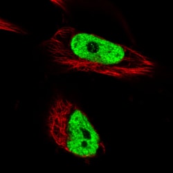 Invitrogen hnRNP C Monoclonal Antibody (CL2593) 100 &mu;L; Unconjugated:Antibodies,