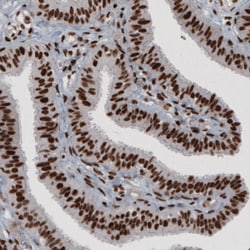 Invitrogen hnRNP C Monoclonal Antibody (CL2593) 100 &mu;L; Unconjugated:Antibodies,