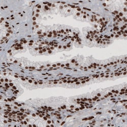 Invitrogen hnRNP C Monoclonal Antibody (CL2593) 100 &mu;L; Unconjugated:Antibodies,