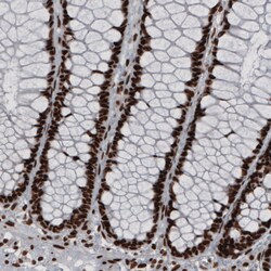 Invitrogen hnRNP C Monoclonal Antibody (CL2593) 100 &mu;L; Unconjugated:Antibodies,