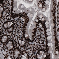 Invitrogen hnRNP C Monoclonal Antibody (CL2593) 100 &mu;L; Unconjugated:Antibodies,