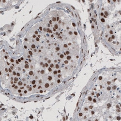 Invitrogen hnRNP C Monoclonal Antibody (CL2593) 100 &mu;L; Unconjugated:Antibodies,