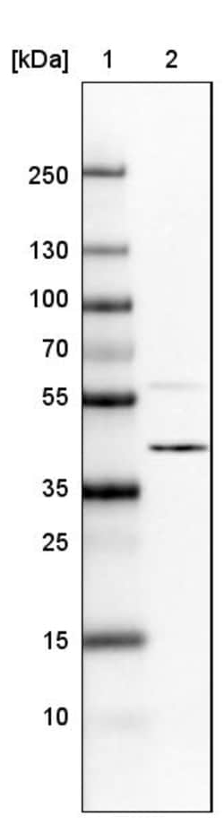 Invitrogen hnRNP C Monoclonal Antibody (CL2593) 100 &mu;L; Unconjugated:Antibodies,