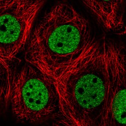 Invitrogen hnRNP C Monoclonal Antibody (CL2596) 100 &mu;L; Unconjugated:Antibodies,