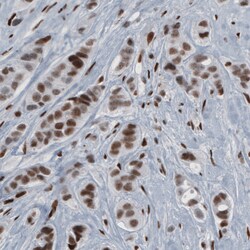 Invitrogen hnRNP C Monoclonal Antibody (CL2596) 100 &mu;L; Unconjugated:Antibodies,