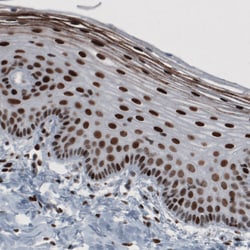 Invitrogen hnRNP C Monoclonal Antibody (CL2596) 100 &mu;L; Unconjugated:Antibodies,