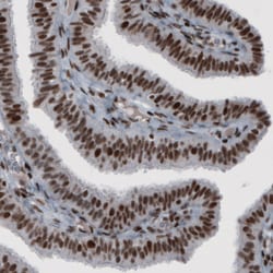 Invitrogen hnRNP C Monoclonal Antibody (CL2596) 100 &mu;L; Unconjugated:Antibodies,
