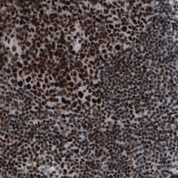 Invitrogen hnRNP C Monoclonal Antibody (CL2596) 100 &mu;L; Unconjugated:Antibodies,