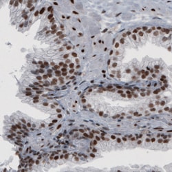 Invitrogen hnRNP C Monoclonal Antibody (CL2596) 100 &mu;L; Unconjugated:Antibodies,