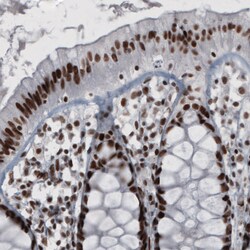 Invitrogen hnRNP C Monoclonal Antibody (CL2596) 100 &mu;L; Unconjugated:Antibodies,