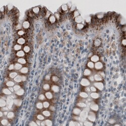 Invitrogen ACAA1 Monoclonal Antibody (CL2650) 100 &mu;L; Unconjugated:Antibodies,