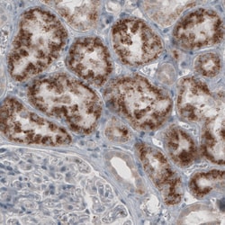 Invitrogen ACAA1 Monoclonal Antibody (CL2650) 100 &mu;L; Unconjugated:Antibodies,